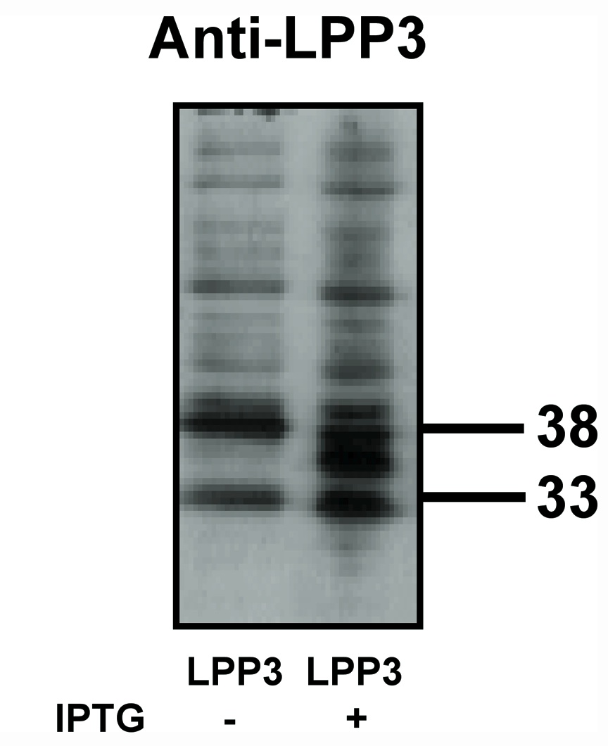 "
Western blot analysis
using LPP3 antibody on
bacterially expressed
LPP3 protein when
untreated (-) and treated
with with 0.1 mM IPTG
(isopropyl-beta-D- thiogalactopyranoside) (+) at a dilution of 10 µg/ml."